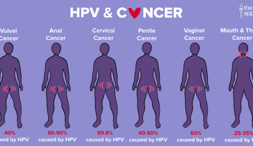 HPV on the curriculum 